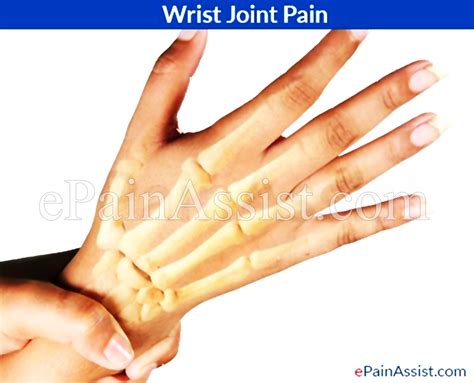 Treatment for Wrist Joint Pain|Complete Treatment Guide for Wrist Pain ... 