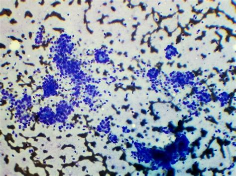 Photomicrograph showing follicular cells formingmicro follicles against... | Download Scientific ...