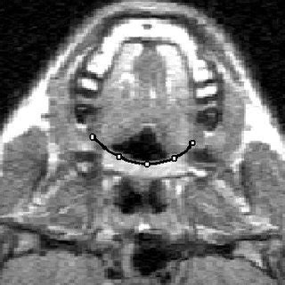 The KTH 3D vocal tract model, based on MRI data of one reference subject. | Download Scientific ...