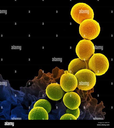 Coloured Scanning Electron Micrograph Sem Of A Neutrophil White Blood