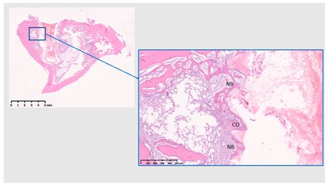 Histological Analysis Of Ti 10 Days NB New Bone CO Contact