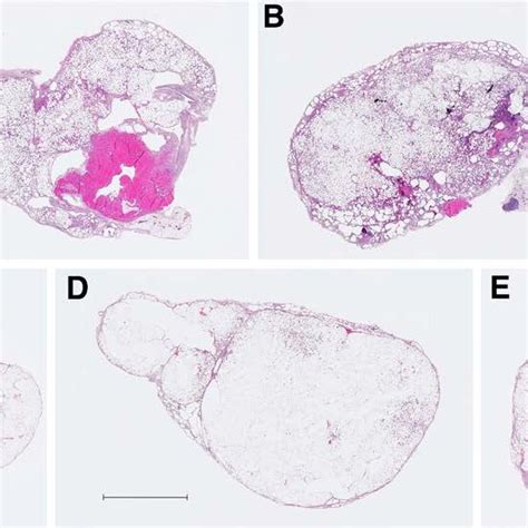 Histological Results Of Grafts Recovered 1 Month After Injection