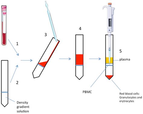 Optimization Of Peripheral Blood Mononuclear Cell Extraction From Small