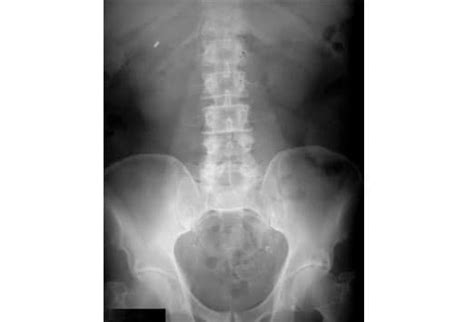 Radiography, Abdominal