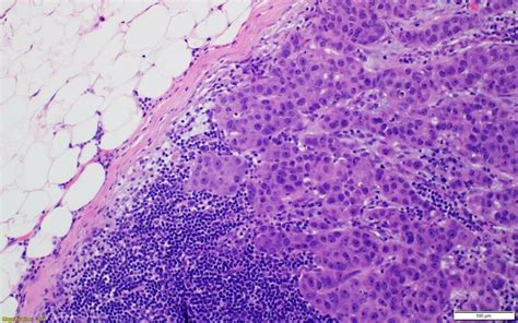 Haematoxylin And Eosin H E Stain At X Magnification Sentinel