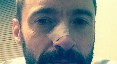 Hugh Jackman à Nouveau Traité Pour Un Cancer De La Peau