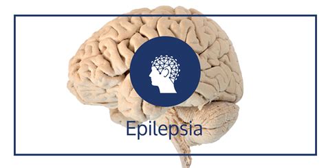 ¿cuáles Son Los Tratamientos Para La Epilepsia