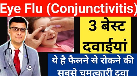 Eye Flu Bachav Kaise Karen Eye Flu तुरंत ये दवा पीना शुरू करो Pink Eye Conjunctivitis