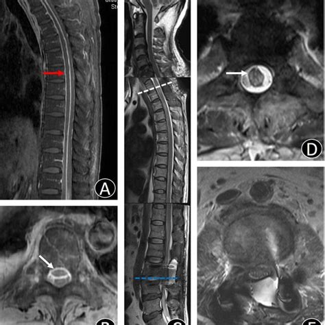 A Sagittal And B Axial T2‐weighted Magnetic Resonance Images Show