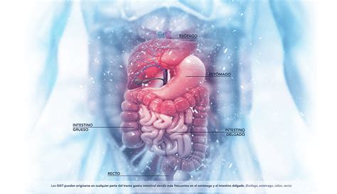 ¿qué Tienes Que Saber Sobre El Cáncer Gastrointestinal Cuidarnos Juntos Andean