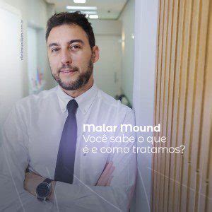 Malar Mound Você sabe o que é e como tratamos Dermatologista