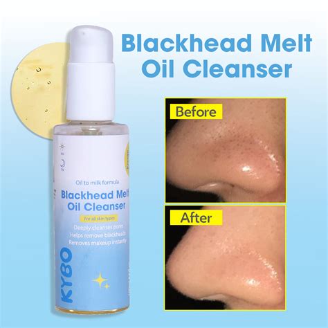 Blackhead Melt Oil Cleanser Kybo