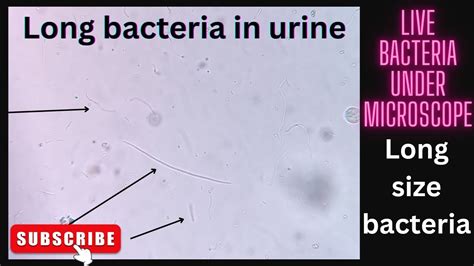 Bacteria In Urine Streptococcus Chain Long Size Bacteria S