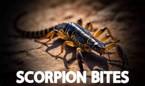 How To Deal With Scorpion Bites: Silicea 200 » 2024