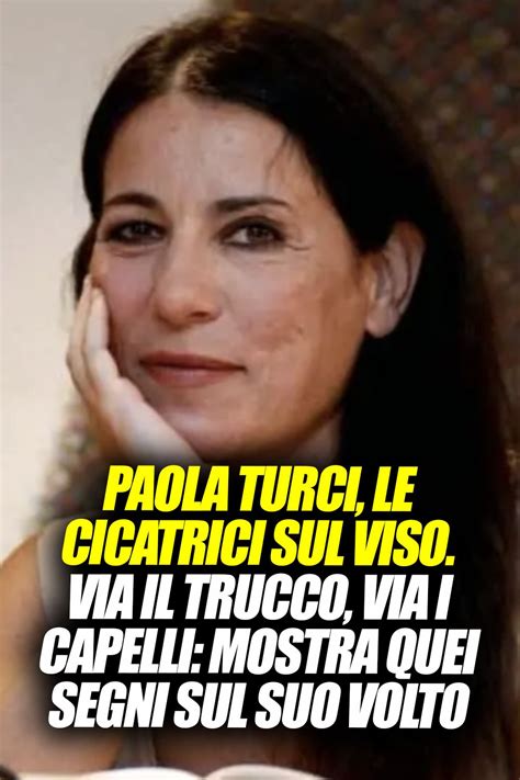 Paola Turci Le Cicatrici Sul Viso Via Il Trucco Via I Capelli