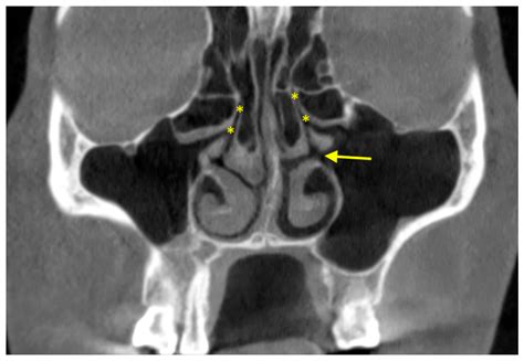 Diagnostics Free Full Text The Use Of Cbct In Evaluating The Health