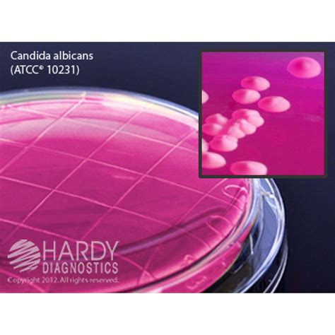 Hardy Diagnostic P42 Dry Culture Media Rose Bengal Agar W