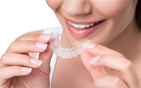 8 Clear Advantages Of Invisalign Aligners Doyle Orthodontics