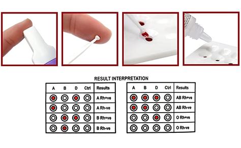 TULIP DIAGNOSTICS ERYCARD 2 0 BLOOD GROUPING RAPID CARD At Rs 85 Pack