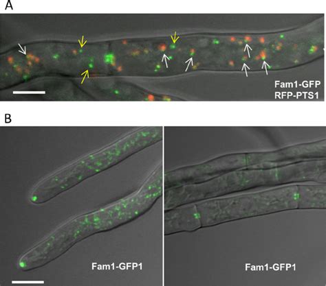 Subcellular Localization Of Fam1 In C Orbiculare A Fam1 GFP And