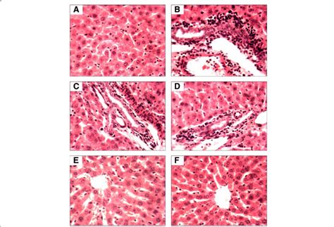 Histopathology Showing The Alterations Induced With Ccl 4 And