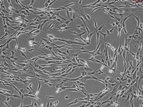 3830 Sc Human Pancreatic Stellate Cells Hpastec Put Into Cell