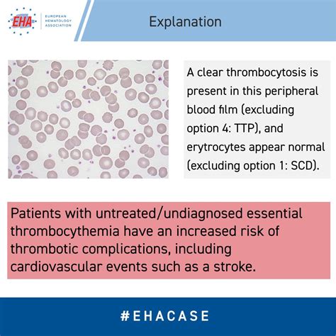 European Hematology Association On Twitter Ehacase Did You Enjoy