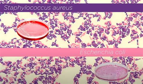 Staphylococcus Aureus Gram Stain