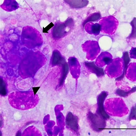 Photomicrograph Of An Impression Smear Of A Punch Biopsy Taken From The