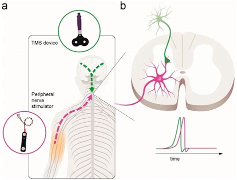 Illustration Of Paired Corticospinal Motoneuronal Stimulation Pmcs