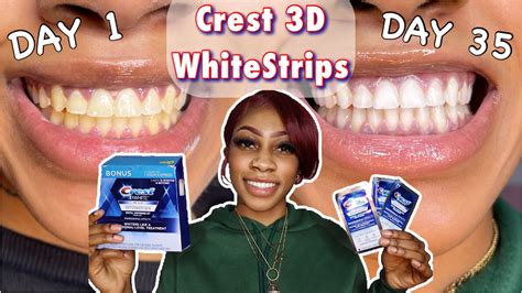 I Tried The Crest D White Strips For Days Off