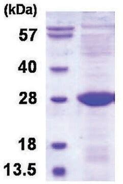 ULBP2 Human Recombinant Expressed In E Coli 85 SDS PAGE Sigma