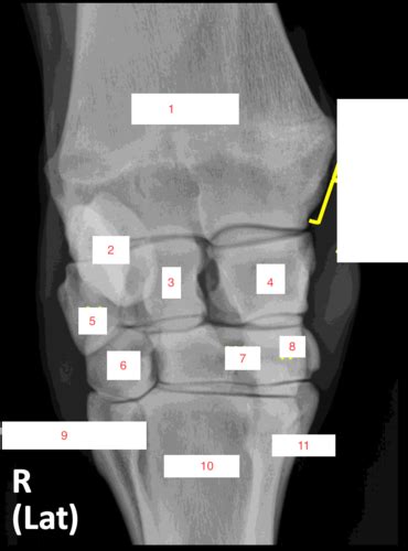Equine Carpus Flashcards Quizlet