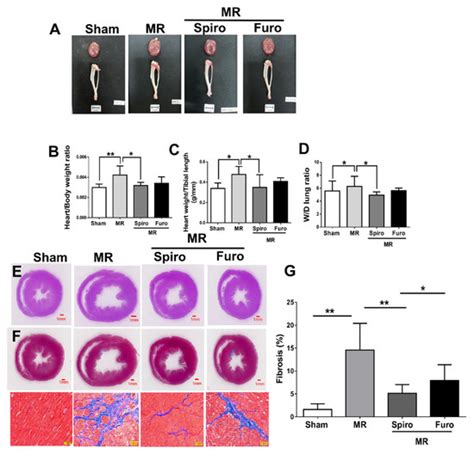 Cells Free Full Text Mineralocorticoid Receptor Antagonists