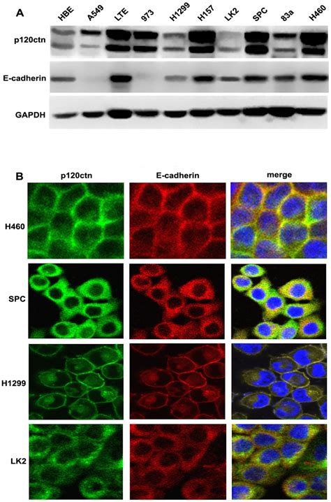 A Western Blot Analyses Showed Expression Of P Ctn And E Cadherin