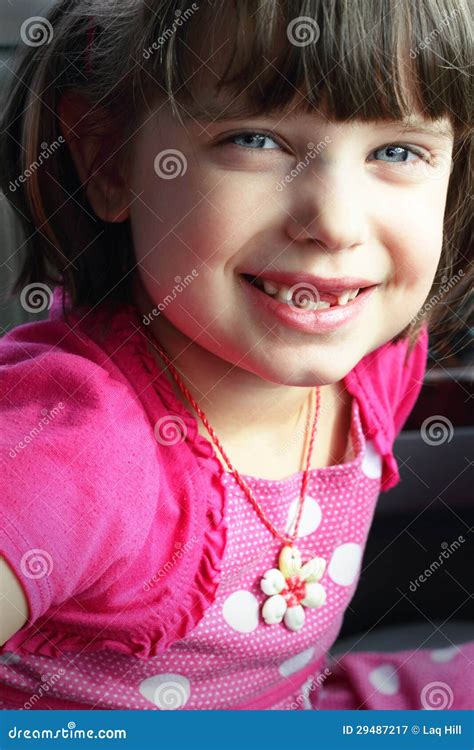 Missing Teeth Smile stock image. Image of eyes, little - 29487217