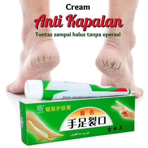 Jual Obat Krim Kaki Pecah Pecah Tangan Tumit Ampuh Kering Tebal