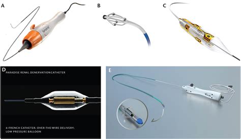 Renal Denervation Past Present And Future