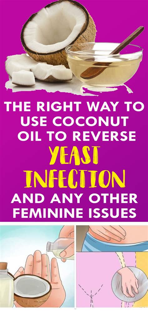 Every Single Way To Use Coconut Oil To Reverse Yeast Infection And Any