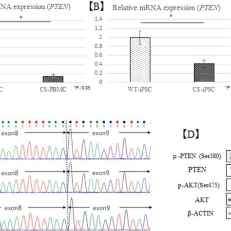 PTEN gene expression and PTEN/AKT pathway activity. (A, B) PTEN mRNA ...