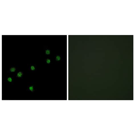 Anti-Centromeric Protein A Antibody (A95132) | Antibodies.com