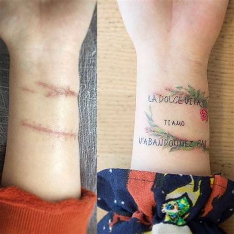 Tatuagem Para Cobrir Cicatriz Dicas E Mais De Ideias