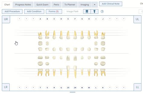 Changing Dentition in the Tooth Chart | Dentrix Ascend