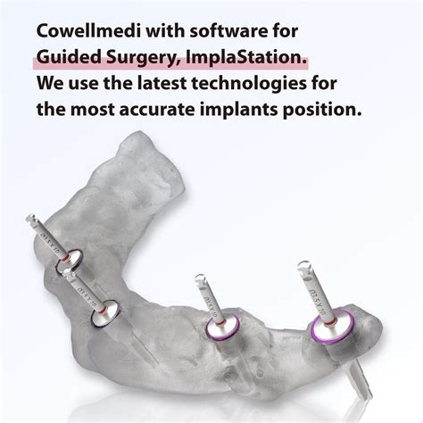 Elevate Dental Restorations With Cowellmedi Implants A Complete