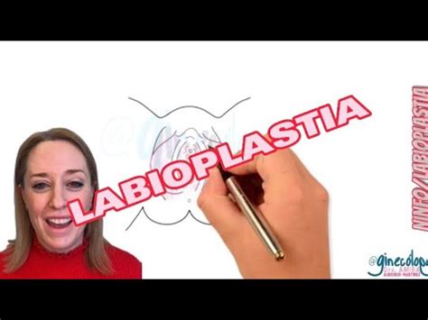 En Qu Consiste La Labioplastia O Ninfoplastia Realizada Por Una