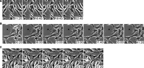 Formation Of Macropinosomes From Linear Ruffles And Circular Dorsal