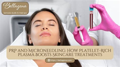 PRP And Microneedling How Platelet Rich Plasma Boosts Skincare