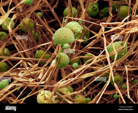 Coloured Scanning Electron Micrograph SEM Of Fungal Cells The Stock