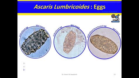 Ascaris Lumbricoides Life Cycle Pathogenesis Lab 43 Off