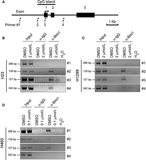 Repression Of Noxa By Bmi Contributes To Deguelininduced Apoptosis In